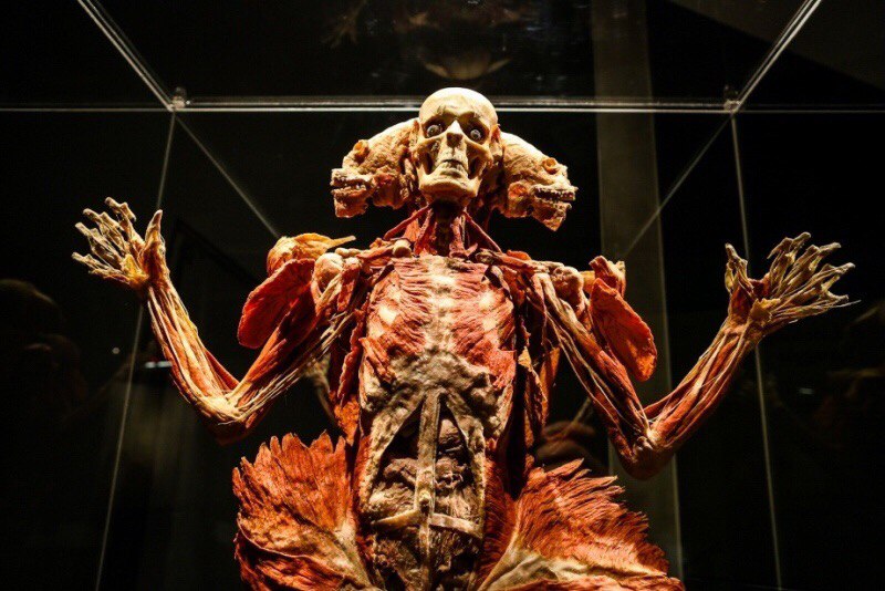 Body Worlds