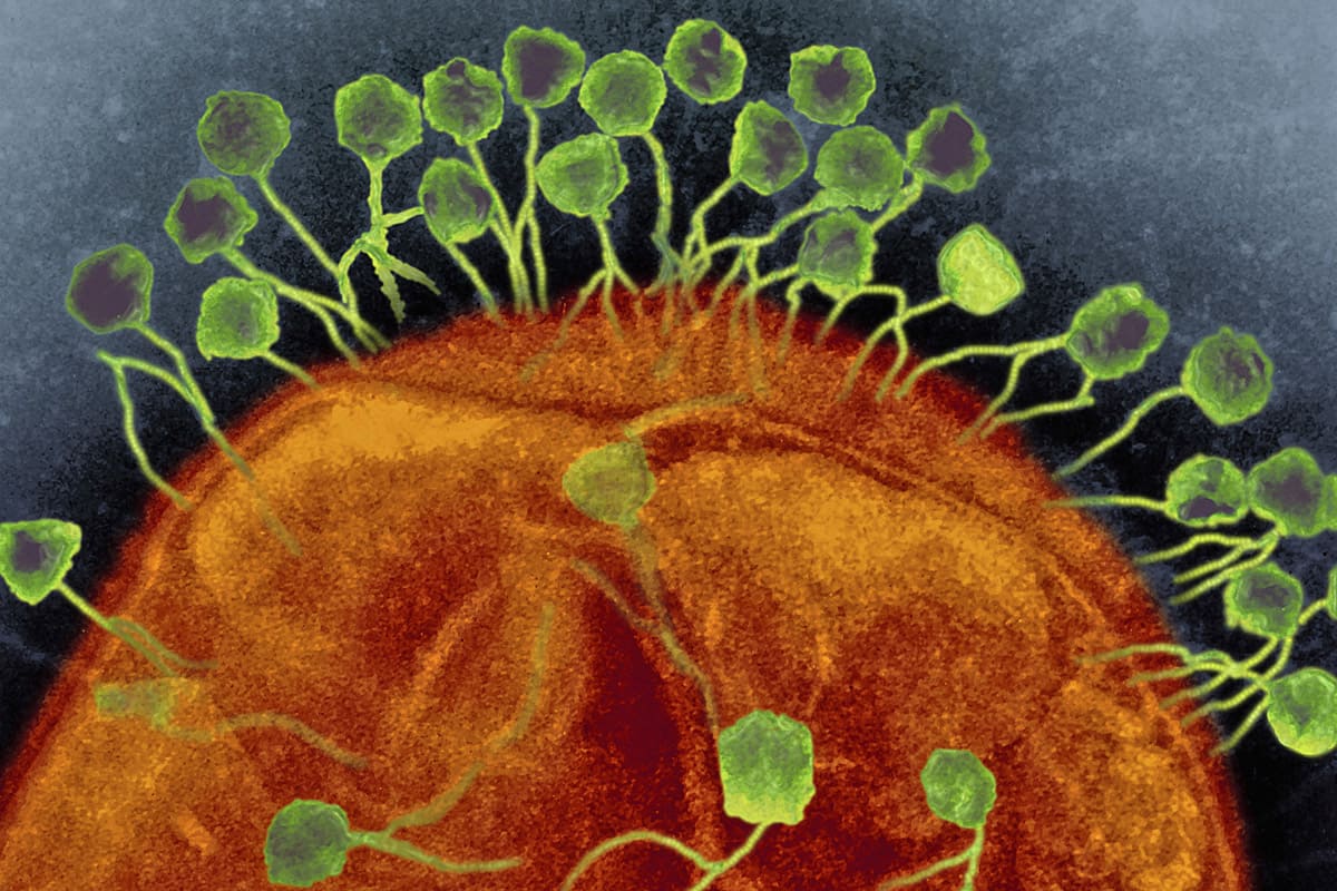 MERS: новый вирус-убийца